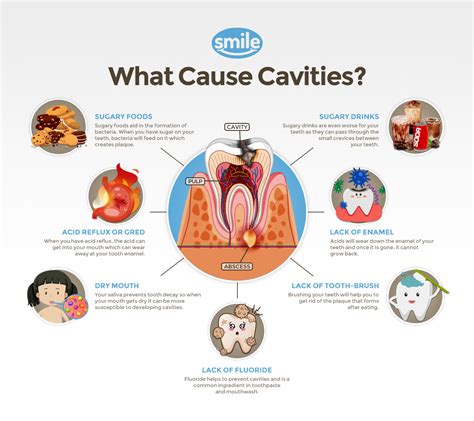 Pediatric Dentistry | What are the causes of cavities