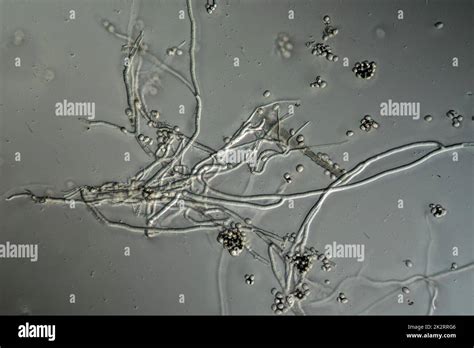 Mold filaments and spores from the Aspergillus mold under the ...