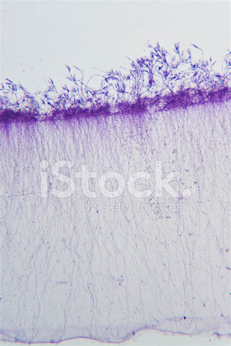 Penicillium Under Microscope Stock Photo | Royalty-Free | FreeImages