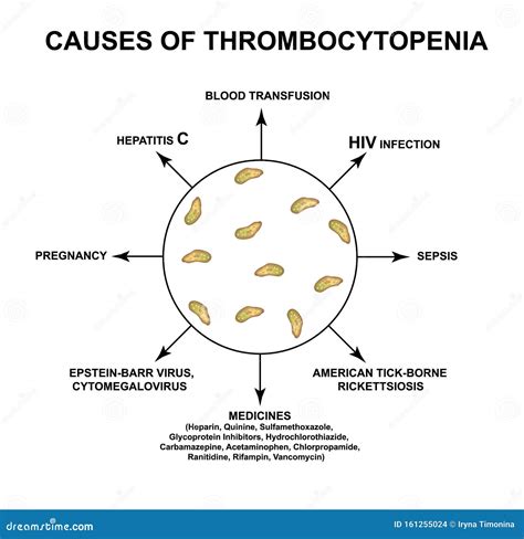 Causes Of Thrombocytopenia. Reducing Platelets In The Blood ...