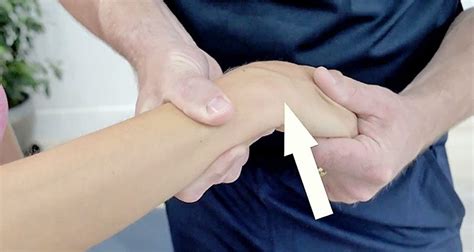 TFCC Tear Test For Diagnosing Wrist Pain | Do I have a TFCC tear?