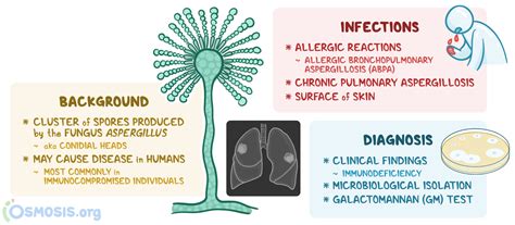 Sources Of Aspergillus