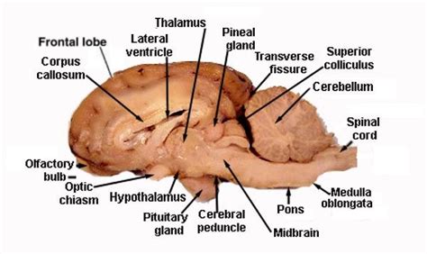 horse-brain-2 @ Hira Laboratories