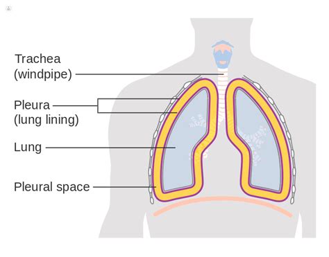 Pleural biopsy: what is it used to diagnose? | Top Doctors