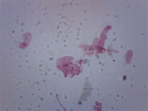 Eisco Prepared Microscope Slide - Sarcodina Amoeba Proteus, Whole Mount ...