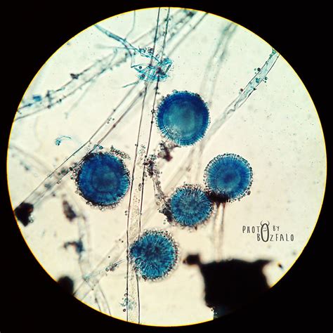 Aspergillus:Microscopic - a gallery on Flickr