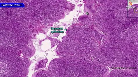 Pharyngeal Tonsil Histology