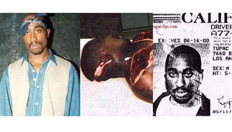 Tupac Shakur Death Autopsy