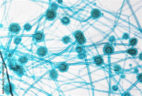 Aspergillus under microscope Stock Photo | Adobe Stock