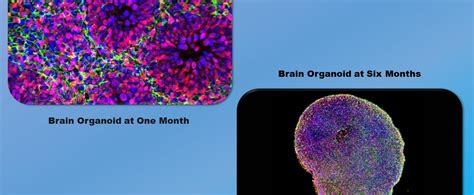 New models accelerate human brain research while sparking debate ...