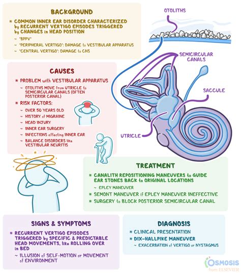 Benign Paroxysmal Positional Vertigo: What Is It, Causes, Treatment ...