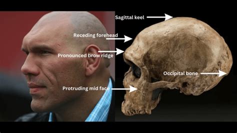 6 Neanderthal DNA physical traits in modern humans