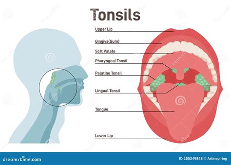 Tonsils. Human Lymphoid Organs Stock Vector - Illustration of medical ...