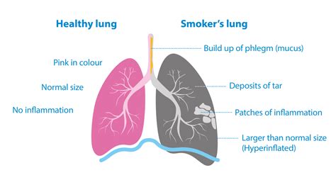 Why is smoking bad for you? The effects of smoking | Asthma + Lung UK