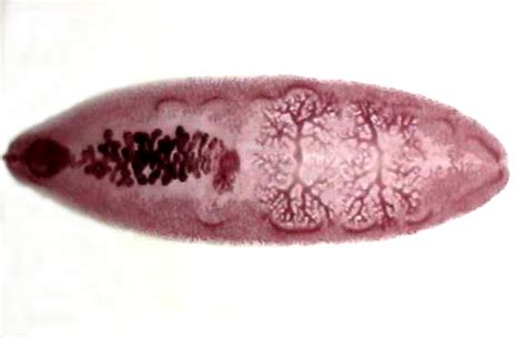 Fasciolopsis buski :: Parasitology