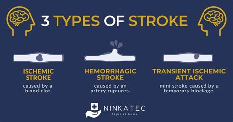 Stroke Symptoms: What Are The Early Signs Of Stroke? | Ninkatec