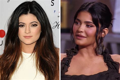 Kylie Jenner, 23, accused of getting 'too much filler' in her face ...