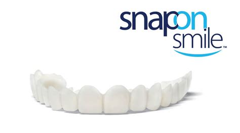 What is Snap-on Smile: Benefits, Procedure, Cost, Durability