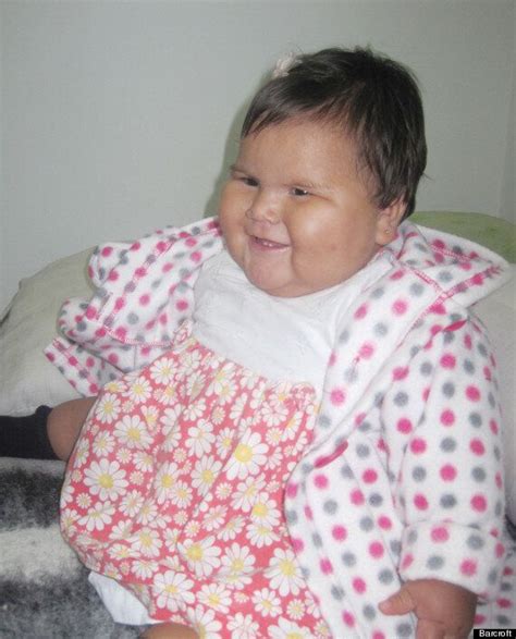 Obese Baby With Mystery Illness Weighs 20Kgs At Just 10 Months Old ...