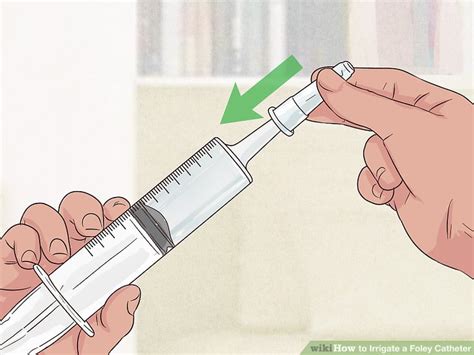 How to Irrigate a Foley Catheter (with Pictures) - wikiHow