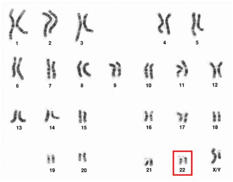 Chromosome – The Science of Parkinson's