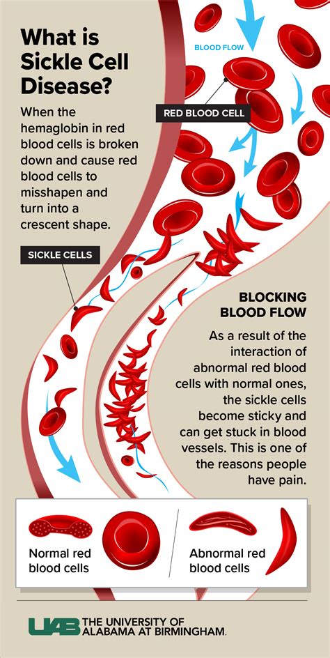 Gene therapy: What to know about the new FDA-approved treatment for ...