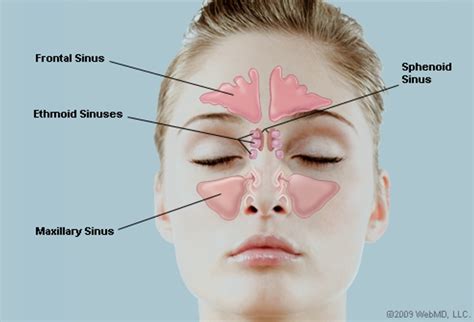 What Are the Sinuses? Pictures of Nasal Cavities