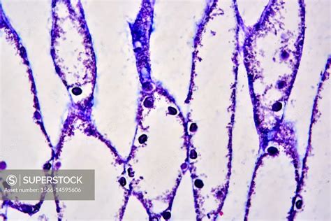 Calcareous sponge (Sycon) cross section showing choanocyte chambers ...