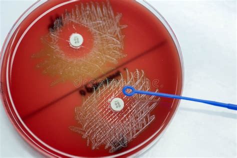 Optochin Subsensitivity Test on Blood Agar Plate Contains Small Stock ...