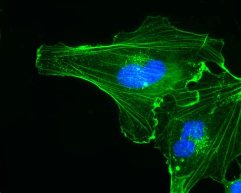 ESA - Endothelial cells