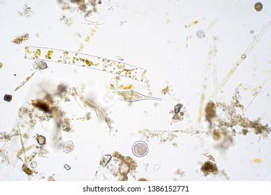 Marine Aquatic Plankton Under Microscope View Stock Photo (Edit Now ...