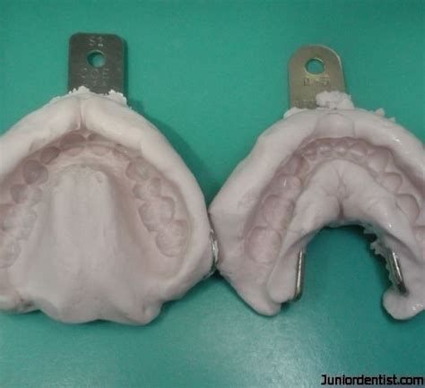 Alginate Impression material | Alginate Dental Impression