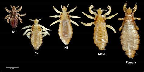 Body Lice - What Does Body Lice Look Like? - Symptoms & Treatment