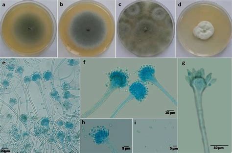 Aspergillus fumigatus- An Overview