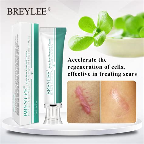 BREYLEE Acne Scar Removal Cream 30g Face Cream Skin Repair Skin Care ...