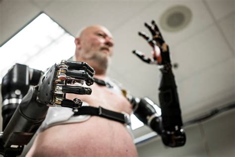 Prosthetic Limbs, Controlled by Thought - The New York Times