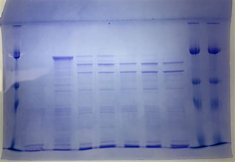 Off Target Thrombin Cleavage? | ResearchGate