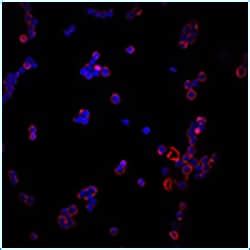 CD11b Expression, Leukocyte Adhesion and the Innate Immune System ...