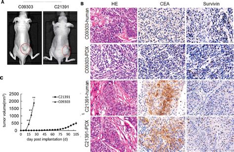 PDX model well maintains pathological features of patient tumors. (A ...