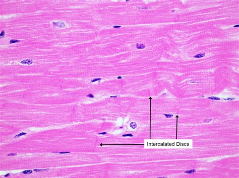 Cardiac Muscle Slide