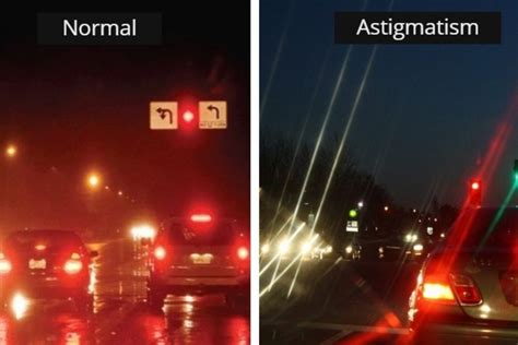 A Complete Guide to Astigmatism: Symptoms, Causes.