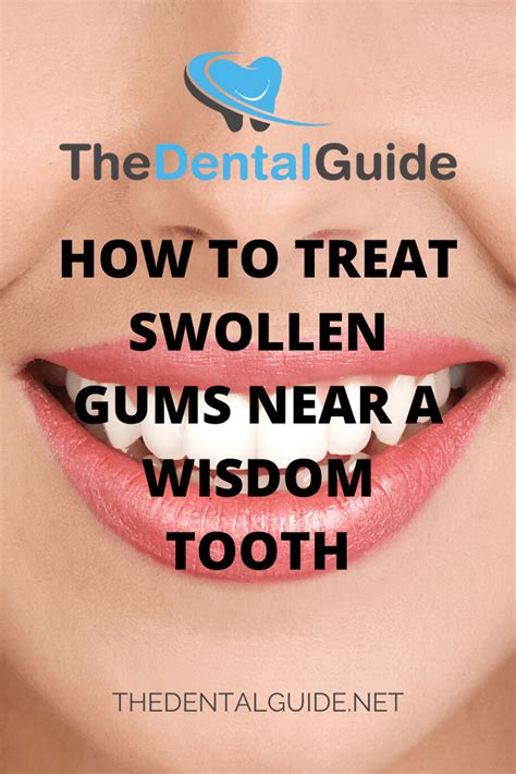 How To Treat Swollen Gums Near A Wisdom Tooth - The Dental Guide