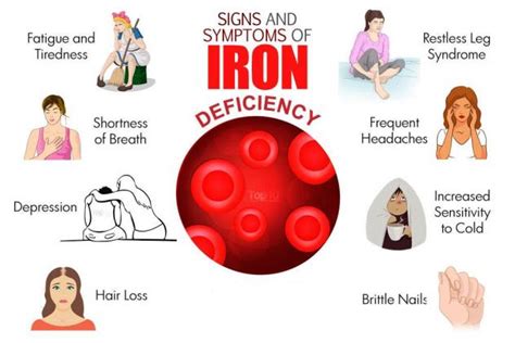 Iron deficiency anemia