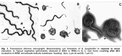 The Reality of Lyme Disease Infectiousness