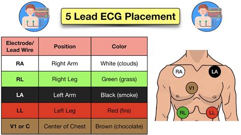 12 Lead ECG Placement: Diagram And Mnemonic For Limb And, 50% OFF