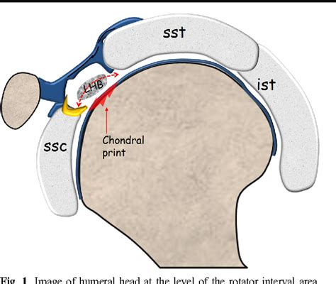 Biceps Tendon Pulley