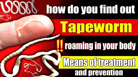 10 Early Signs Of A Tapeworm To Never Ignore