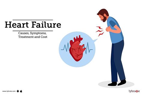 Heart Failure: Treatment, Procedure, Cost, Recovery, Side Effects And More