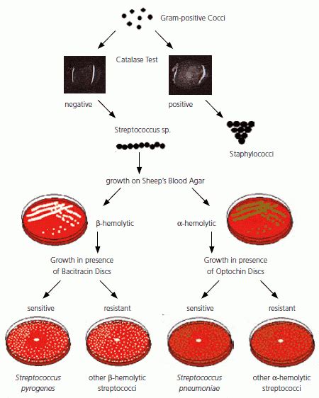 Optochin Sensitivity Test: Principle, Procedure, Results • Microbe Online