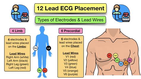 12 Lead ECG Placement: Diagram and Mnemonic for Limb and Precordial ...